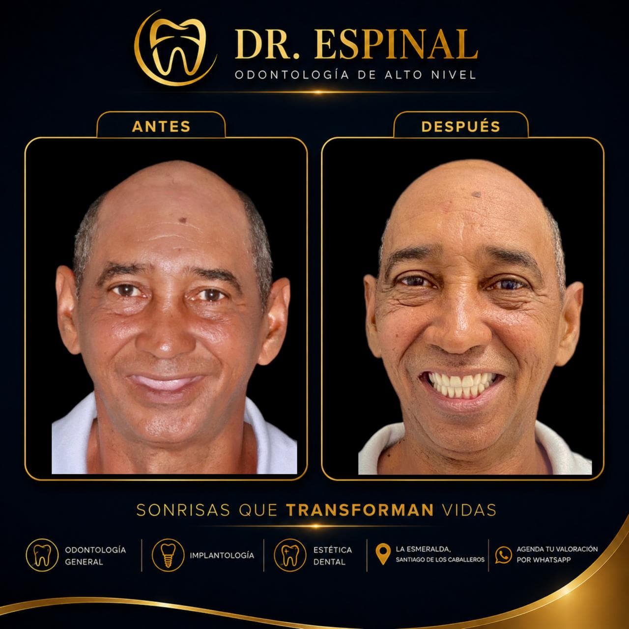 Diseño de sonrisa completo
