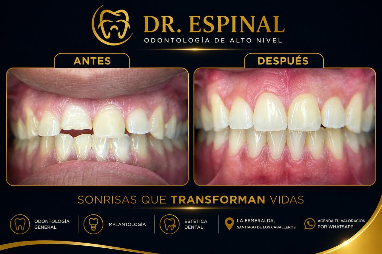 Alineación y ortodoncia