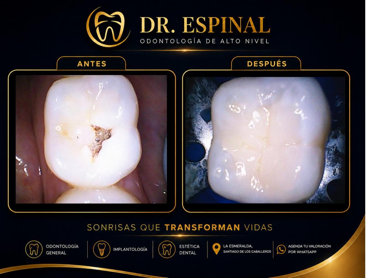 Estética dental