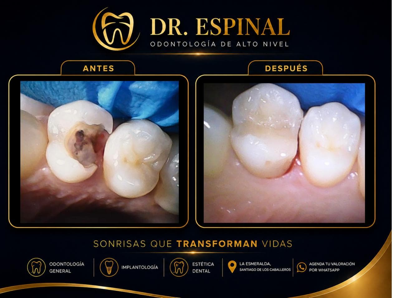 Diseño de sonrisa