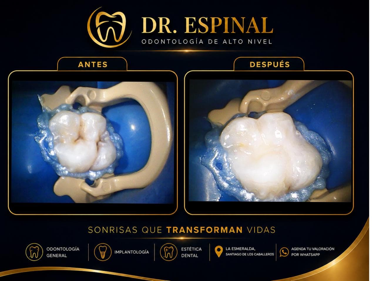 Estética dental