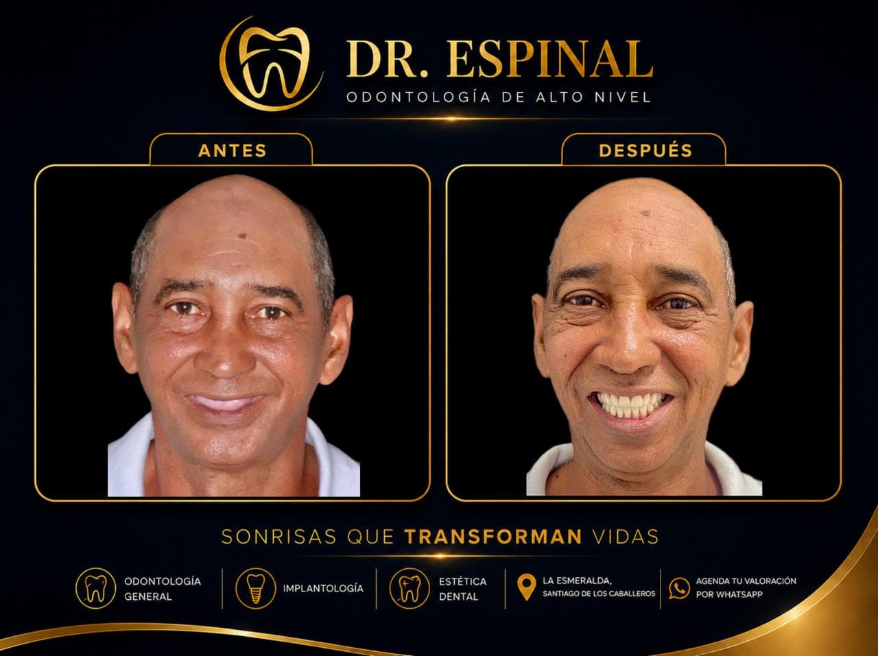 Restauración dental