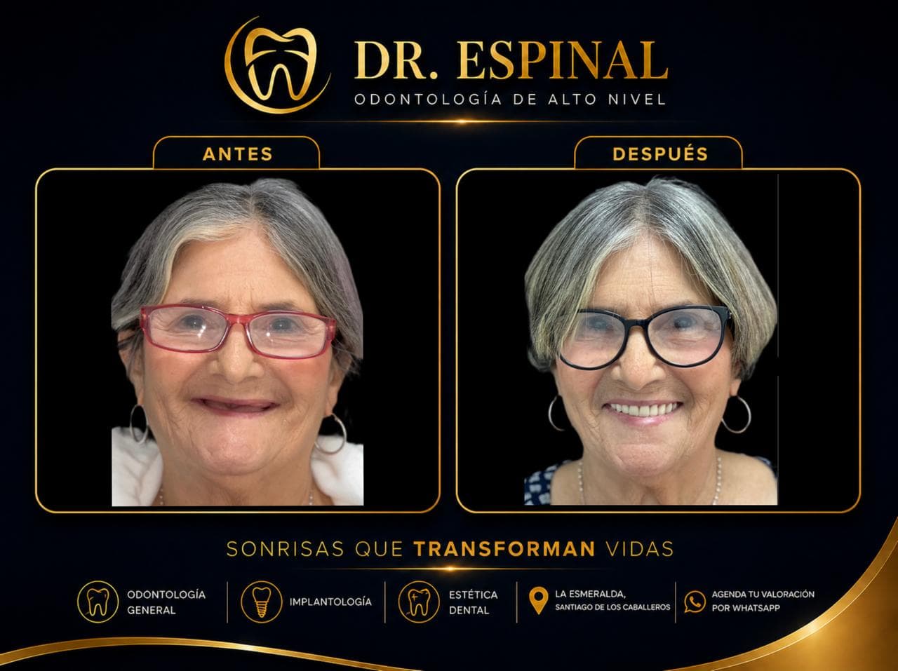 Diseño de sonrisa