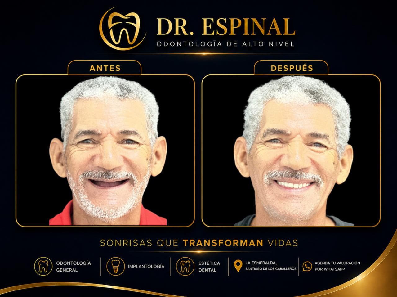 Blanqueamiento dental