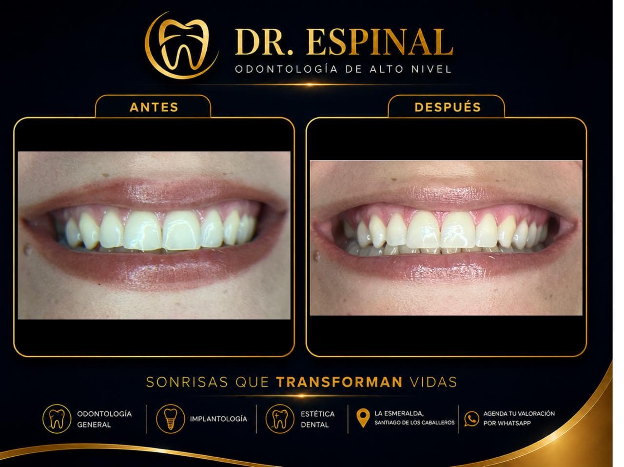 Restauración dental