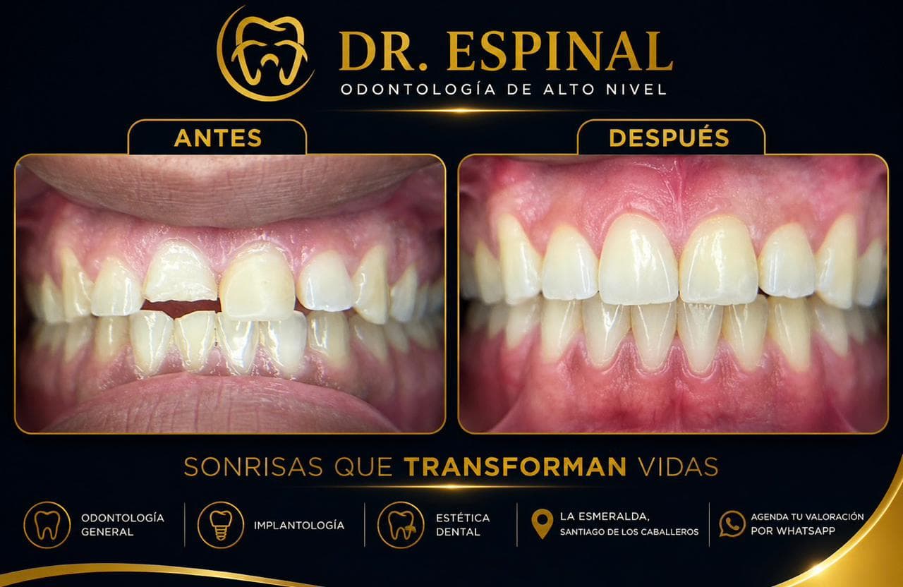 Estética dental